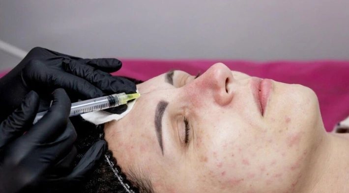 Skin Treatment in Baner