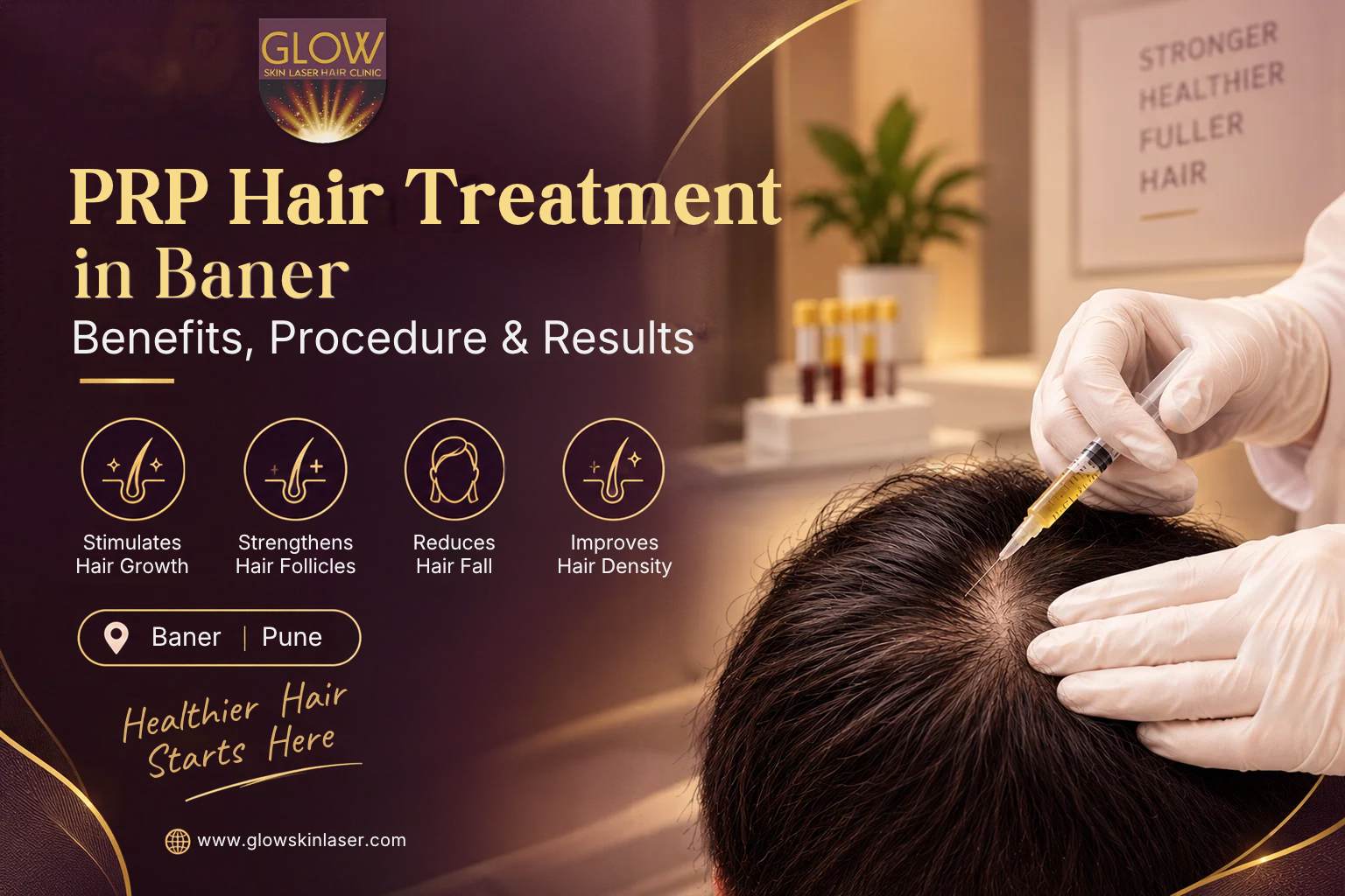 PRP Hair Treatment (1)